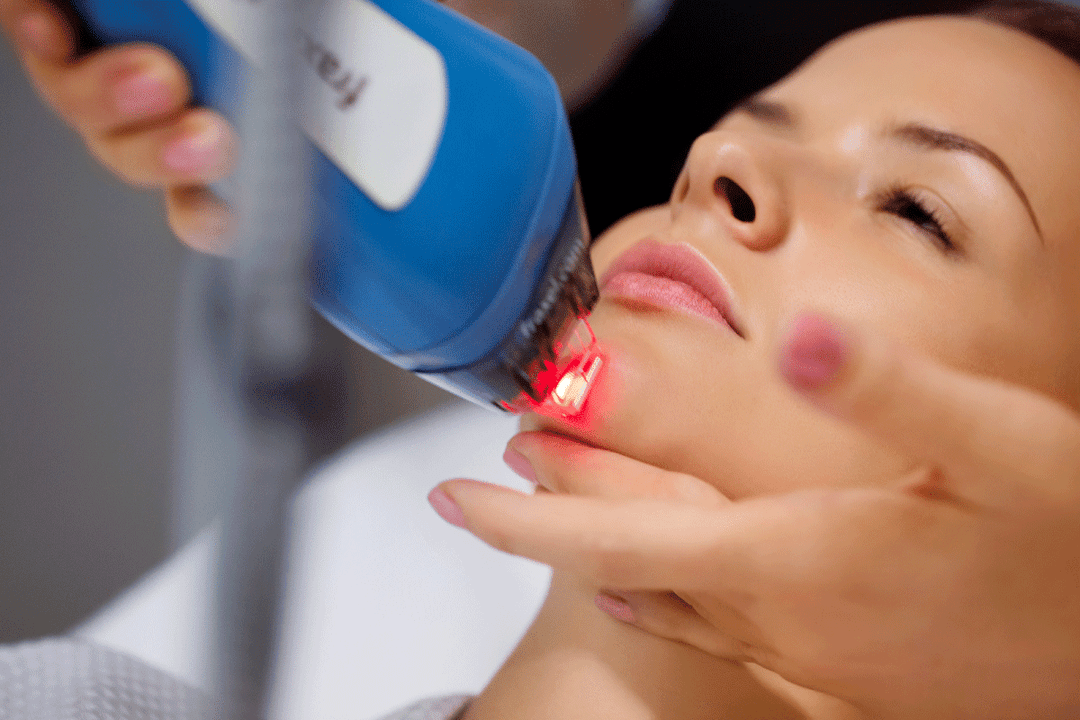 facial skin rejuvenation with laser