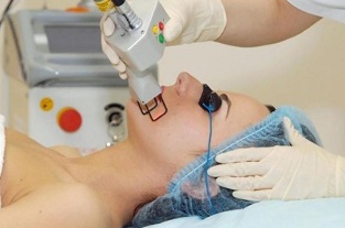 Laser types of facial skin rejuvenation